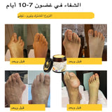 كريم علاج التهاب المفاصل بسم النحل من ArthroEase (خصيصًا لكبار السن وتوصي به AAOS)