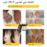 كريم علاج التهاب المفاصل بسم النحل من ArthroEase (خصيصًا لكبار السن وتوصي به AAOS)