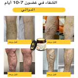 كريم علاج التهاب المفاصل بسم النحل من ArthroEase (خصيصًا لكبار السن وتوصي به AAOS)