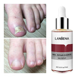 LANBENA ألف280 مصل إصلاح الأظافر الفطري سيروم